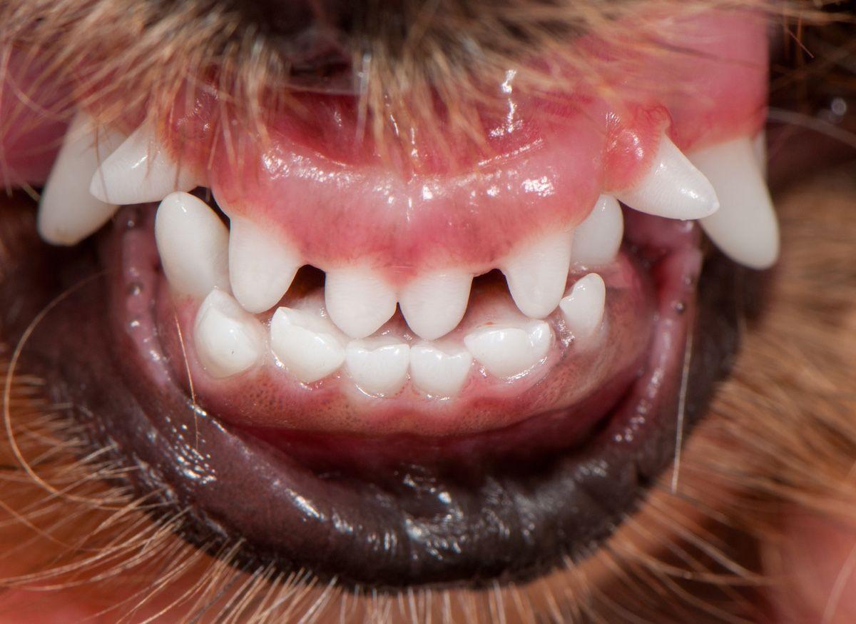 Figure 4: Mandibular mesioclusion and mandibular/maxillary asymmetry (wry bite).