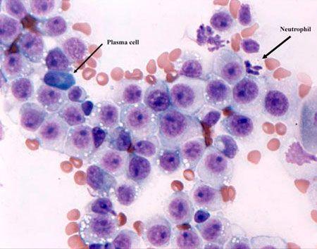 ImageQuiz_cytologyonly_Q8_450-791585-1384156380815.jpg