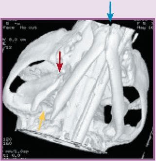 Jaw-Fx-2-792708-1384155541658.jpg