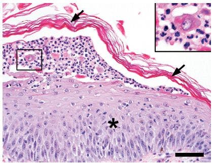 Figure3_Case2_Histo-726521-1384190056793.jpg