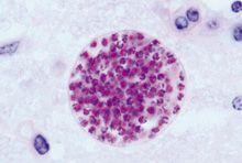 Veterinary_1280px-Toxoplasma_gondii_tissue_cyst_in_mouse_brain_220px.jpg