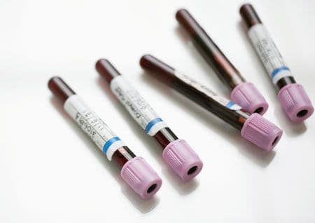 veterinary_1011_blood_vials_450w-743841-1384181301539.jpg