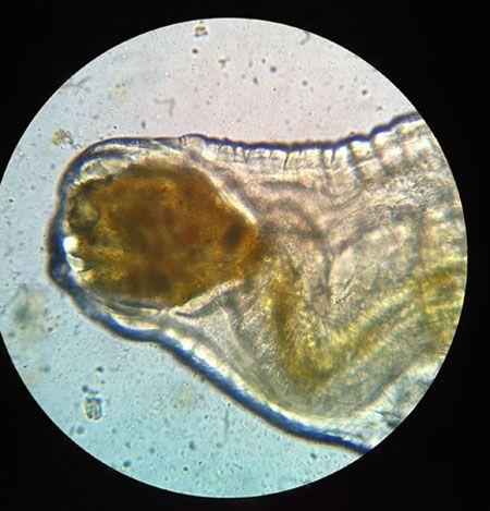 veterinary_hookworm2-756946-1384165524103.JPG