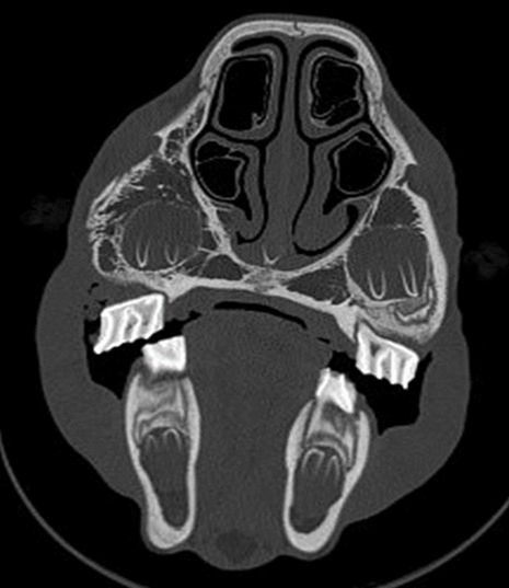 Figure 3b. Corresponding recheck CT of the filly showing good healing of the fracture, which was treated conservatively despite the initially severe displacement.