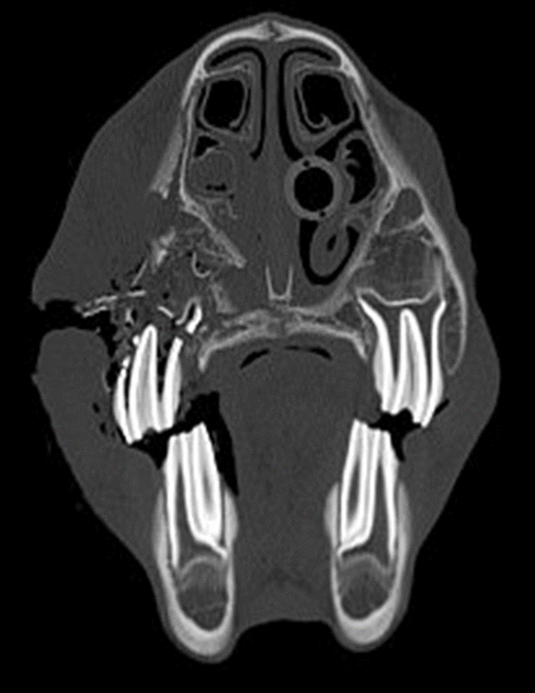 Figure 2b. Corresponding CT image on the right identifying an open, comminuted displaced fracture of the skull involving the 507 tooth.