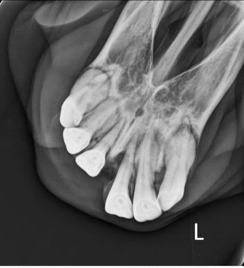 Figure 4. Radiographs identifying marked bulbous and heterogeneous remodelling of the roots of all maxillary incisors, and moderate widening of the periapical and periodontal space surrounding these abnormal roots. This horse also presented an acute, open, and completely displaced simple transverse fracture of the left rostral quarter of the incisive bone.